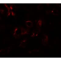 IHC-plus™ Polyclonal Rabbit anti-Human EDA / Ectodysplasin A Antibody (IHC, IF, WB)