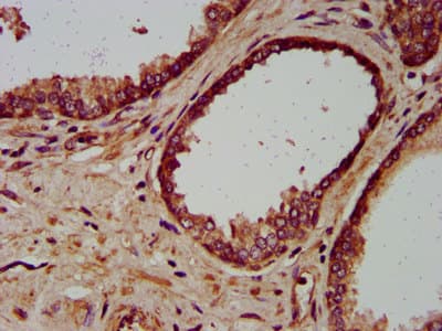 MIP / AQP0 / Aquaporin 0 Antibody