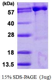 Human PAPSS 1 Protein (Recombinant His)