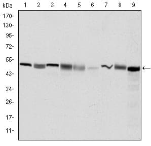 CCT2 / CCT Beta Antibody (clone 5B5F5)