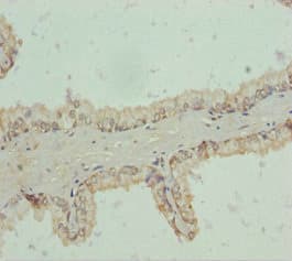 Polyclonal Rabbit anti-Human RNF34 Antibody (IHC, WB)
