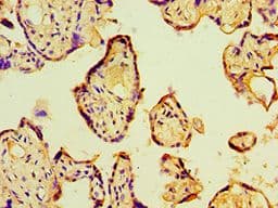 Polyclonal Rabbit anti-Human P4HA2 Antibody (aa236-535, IHC, WB)