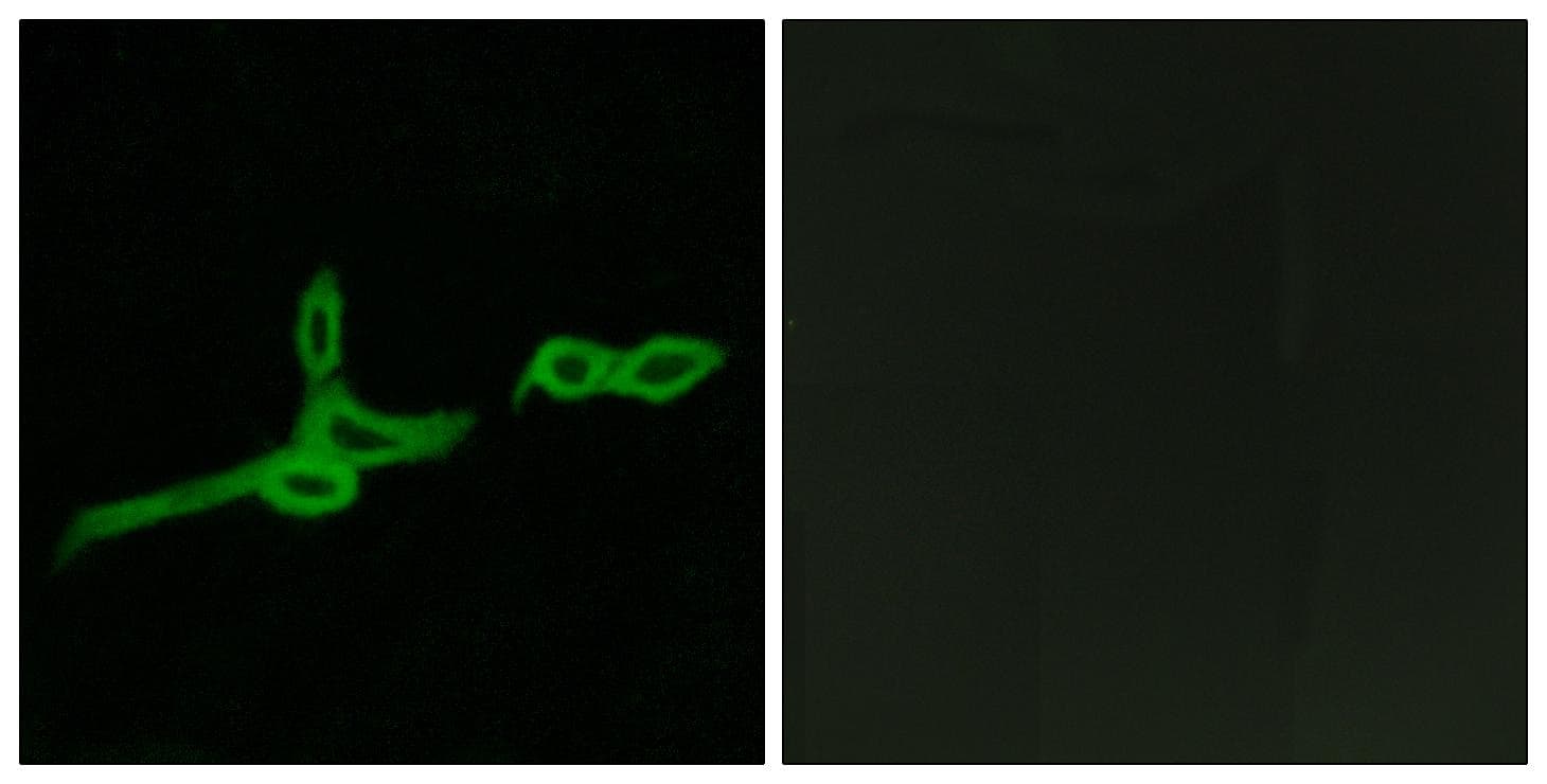 BOB / GPR15 Antibody