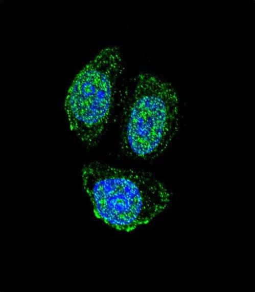 IL17B Antibody (aa39-66)