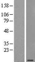 SEC61G Protein (Over-Expression Lysate Myc-DDK (Flag))