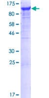 Human VAC14 / TRX Protein (Recombinant GST)