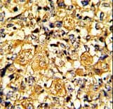 EGFR Antibody (clone 51CT78.40.5)