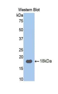 RPN1 / Ribophorin I Antibody (aa180-307, FITC)
