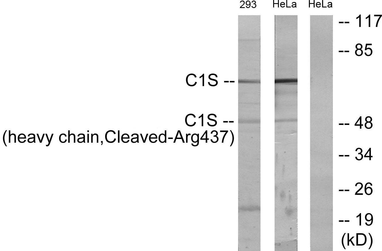 Polyclonal Rabbit anti-Human Complement C1s Antibody (heavy chain,Cleaved-Arg437, WB)