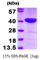 Human CAPG Protein (Recombinant)