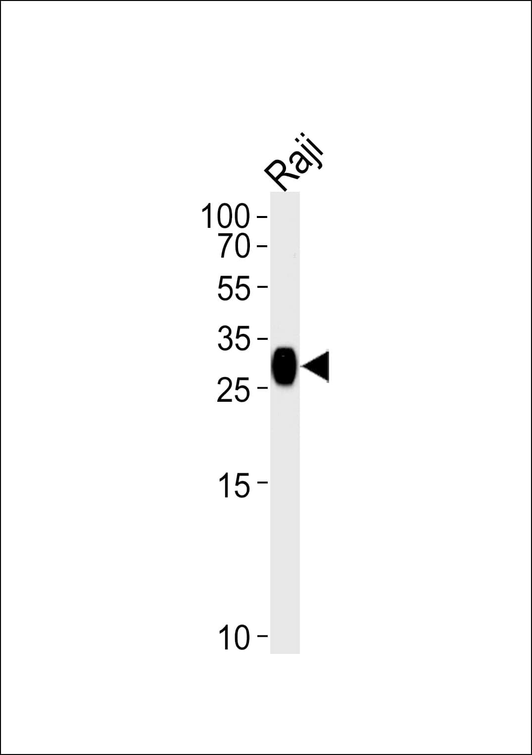 HLA-DRB4 Antibody (aa43-72)