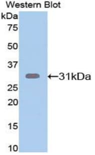 APP / Beta Amyloid Precursor Antibody (aa18-286)