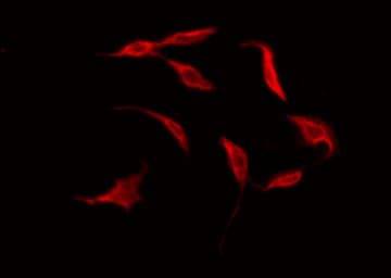 Polyclonal Rabbit anti-Human BRS3 Antibody (IF, WB)