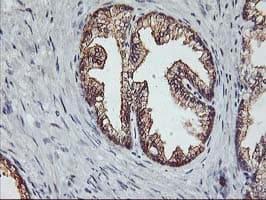 Monoclonal Mouse anti-Human PDSS2 / DLP1 Antibody (clone OTI1E9, IHC, IF, WB)