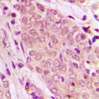 SMAD2+3 Antibody (N-Terminus)