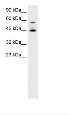 Polyclonal Rabbit anti-Human PAX4 Antibody (aa166-215, IHC, WB)