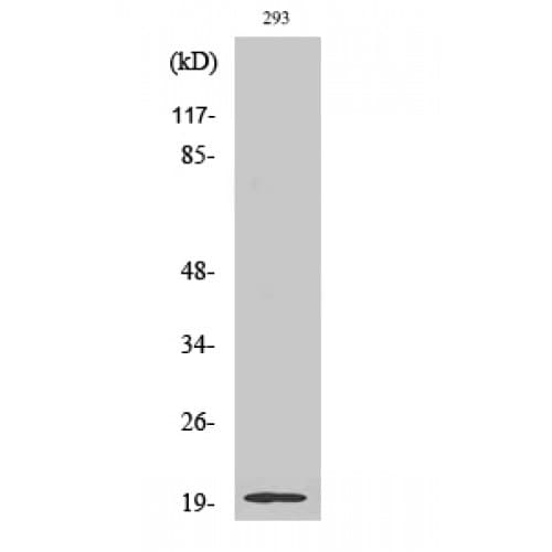 SCLIP / STMN3 Antibody (30-110 aa, Internal)