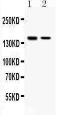SAFB1 / SAFB Antibody
