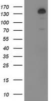 Monoclonal Mouse anti-Human TBC1D4 / AS160 Antibody (clone OTI5A6, IF, WB)