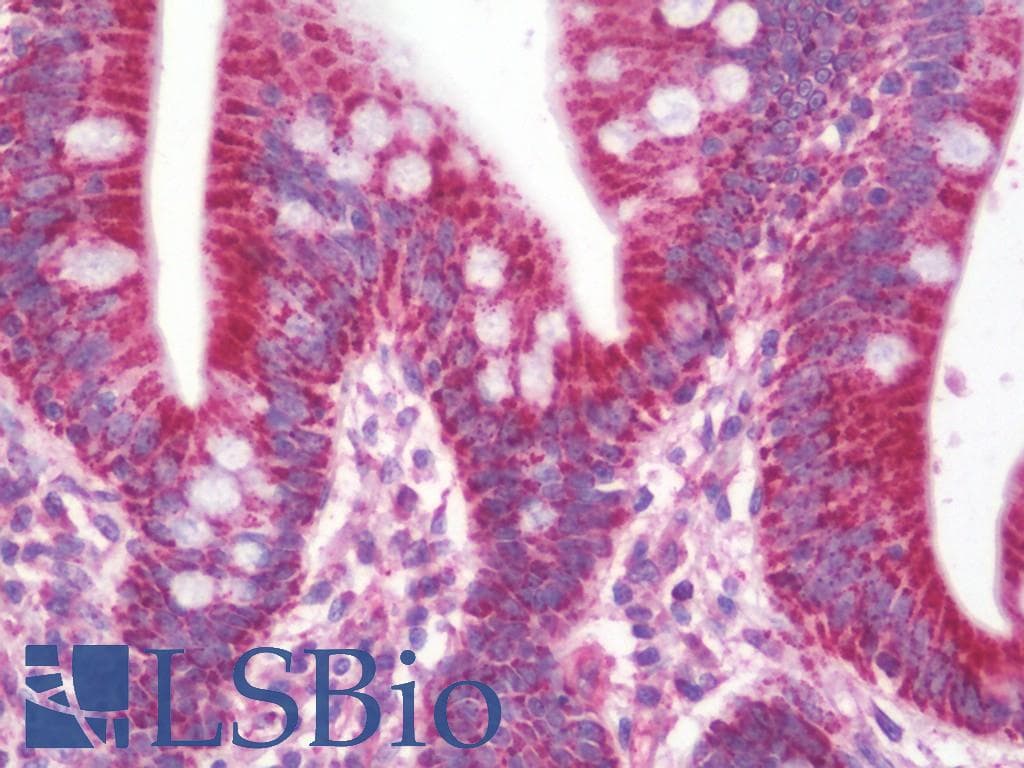 IHC-plus™ Polyclonal Rabbit anti-Human ETHE1 Antibody (aa180-209, IHC, WB)