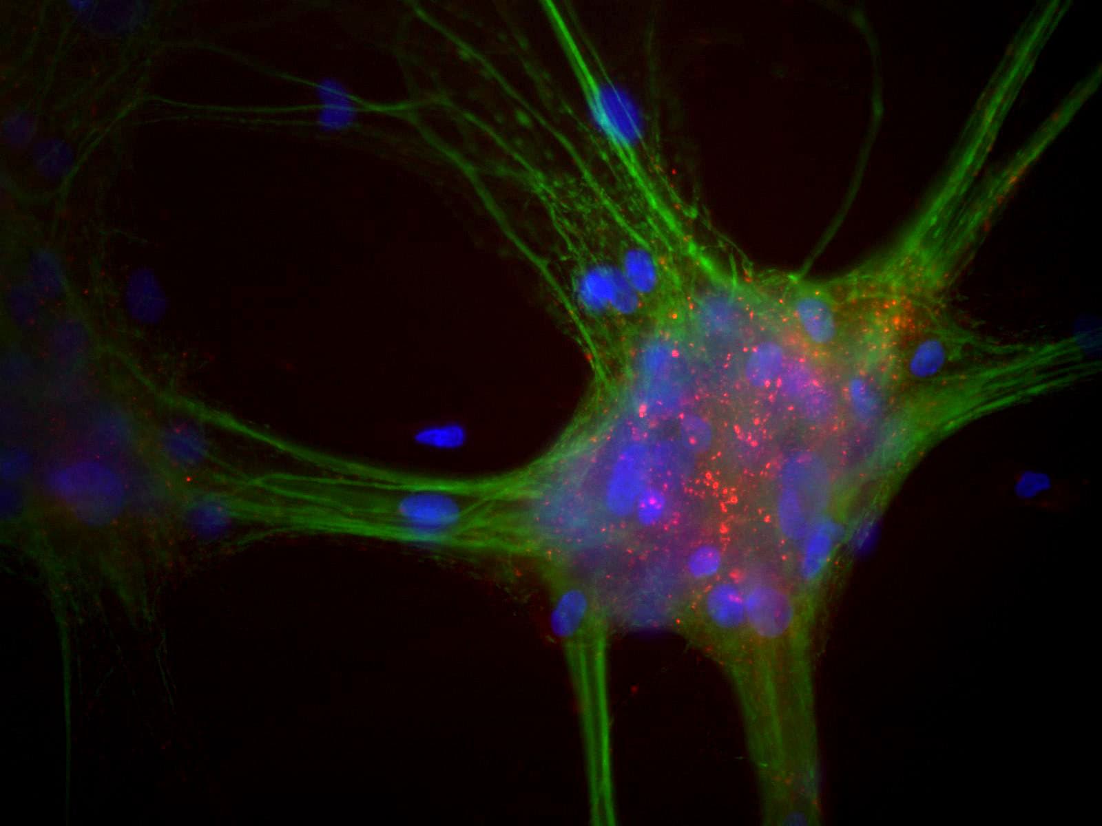 SNCA / Alpha-Synuclein Antibody (clone 3H9)