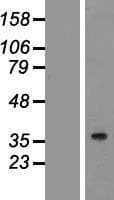 STRADA / LYK5 Protein (Over-Expression Lysate Myc-DDK (Flag))