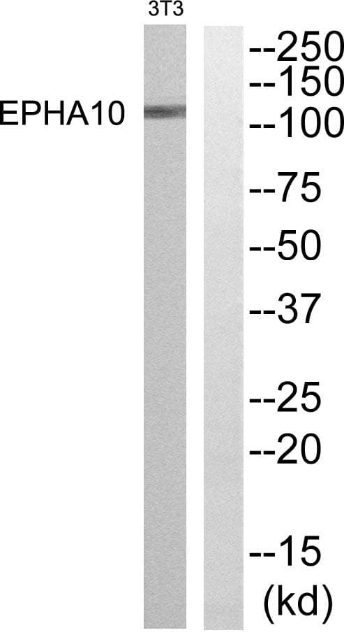EPHA10 / EPH Receptor A10 Antibody