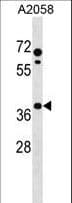 PHLDA1 Antibody (aa23-49)