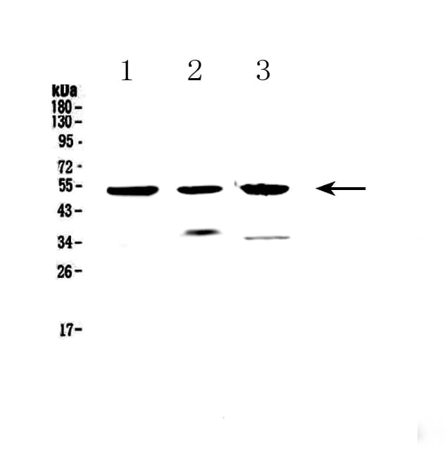 Polyclonal Rabbit anti-Human HTRA1 Antibody (IHC, WB)