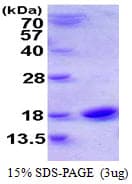 Human CST1 / Cystatin SN Protein (Recombinant His)