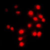 CCNA1/CCNA2 Antibody (Internal)