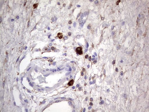 Monoclonal Mouse anti-Human CD63 Antibody (clone OTI5E5, IHC, WB)