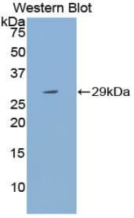 CYP21A2 Antibody (aa200-414, HRP)