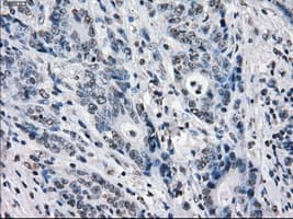 BUB1B / BubR1 Antibody (clone OTI3D9)