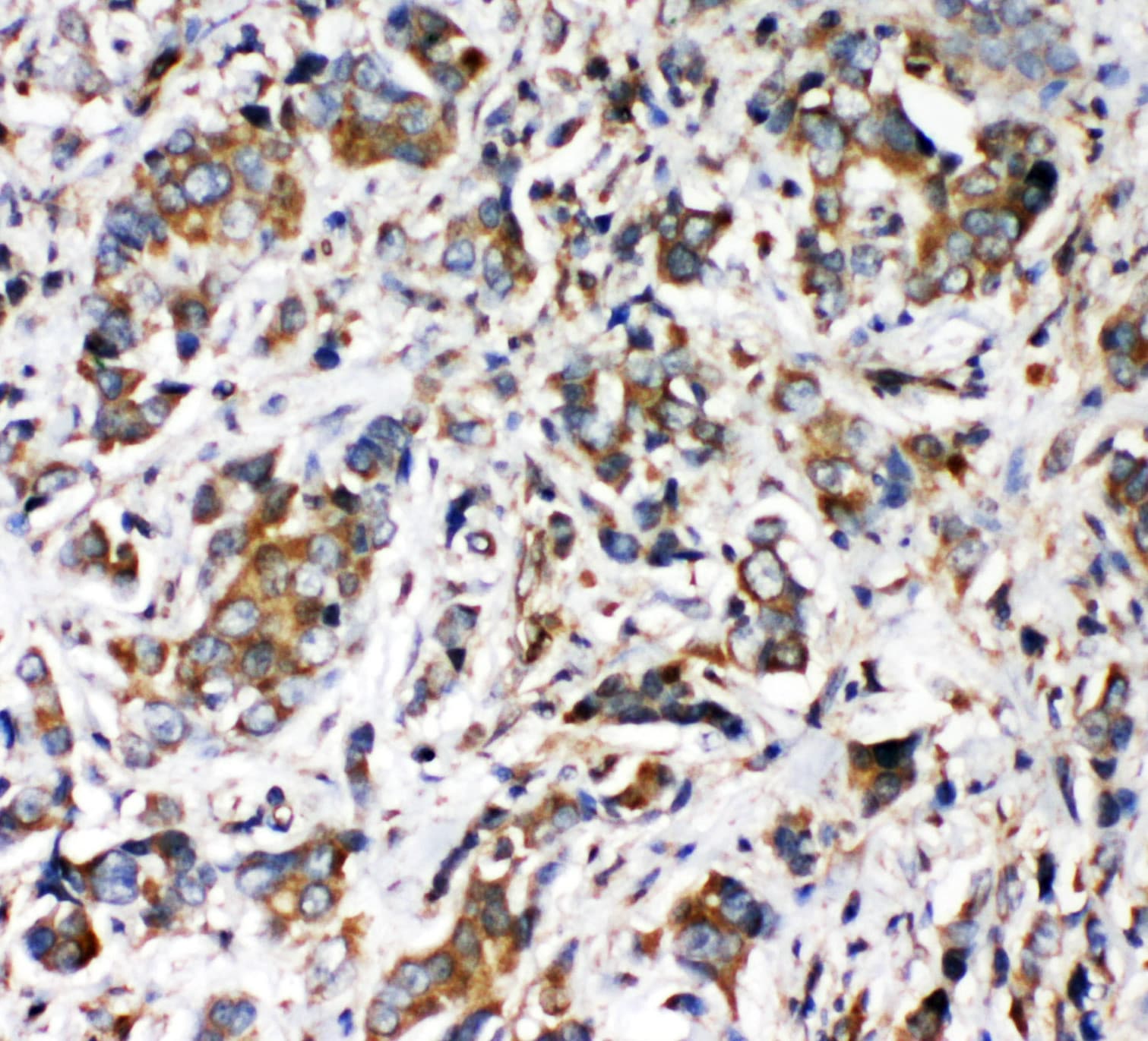 Polyclonal Rabbit anti-Human VRL1 / TRPV2 Antibody (aa42-624, IHC, WB)