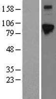 ELAC2 Protein (Over-Expression Lysate Myc-DDK (Flag))