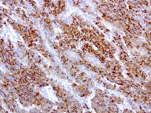 WFDC2 / HE4 Antibody (aa31-124, clone UMAB88, Carrier-free)