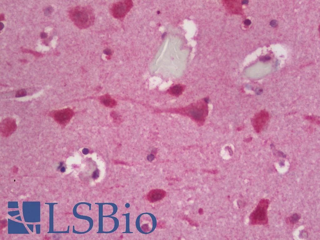 IHC-plus™ AUTL1 / ATG4C Antibody
