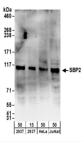 SECISBP2 / SBP2 Antibody (aa804-854)