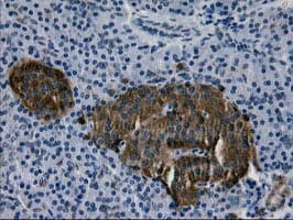 MAC-2-BP / LGALS3BP Antibody (clone 5.00E+03, Carrier-free)