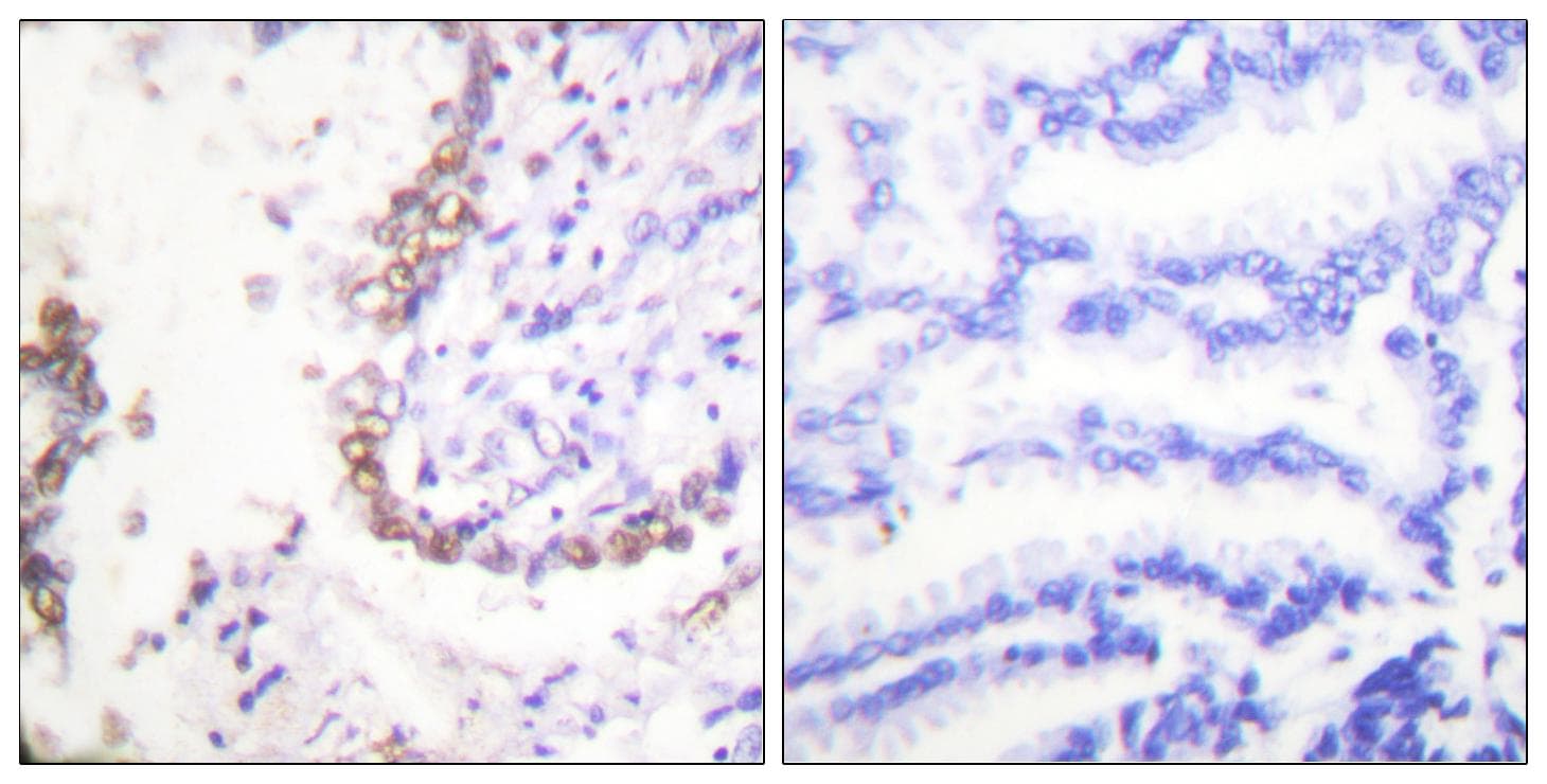 SLC22A3 / OCT3 Antibody