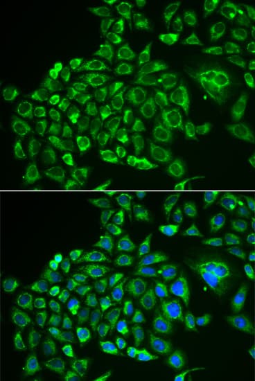 Recoverin Antibody