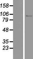 Human LIG1 / DNA Ligase 1 Protein (Over-Expression Lysate Myc-DDK (Flag))