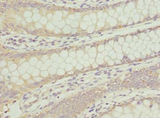 Polyclonal Rabbit anti-Human ANAPC2 / APC2 Antibody (IHC)