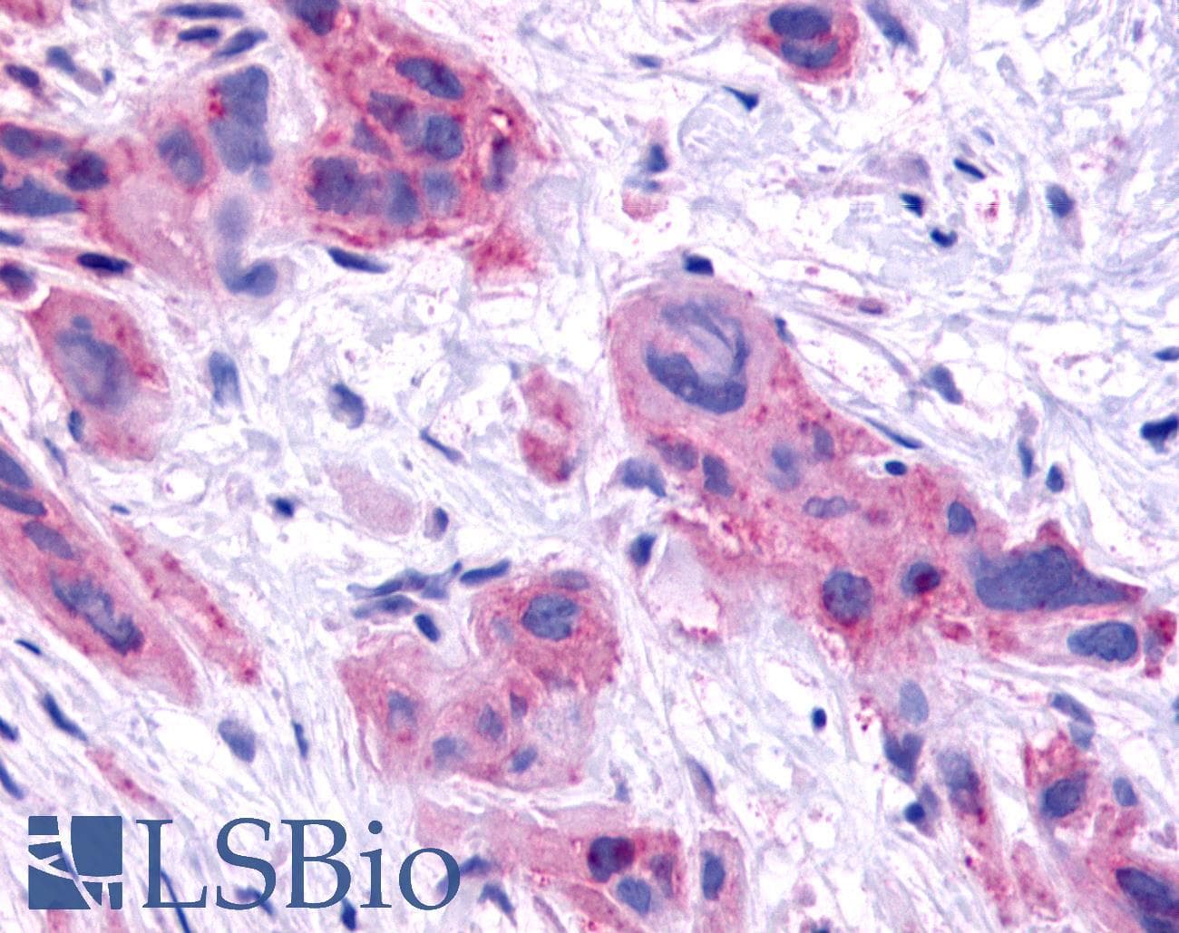 PathPlus™ HNF4G / HNF4 Gamma Antibody (Ligand-binding Domain)