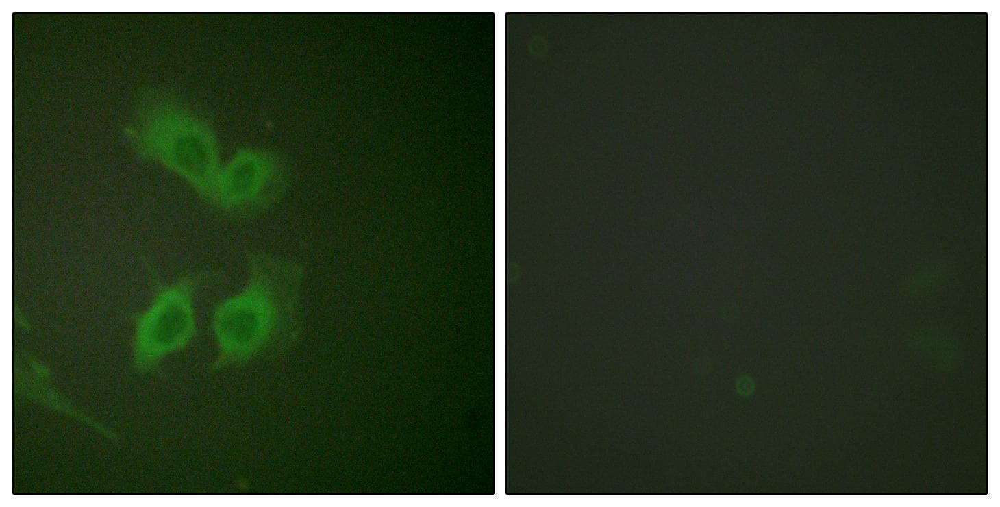 APP / Beta Amyloid Precursor Antibody (p743/668)