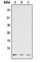 Polyclonal Rabbit anti-Human CCL26 / Eotaxin 3 Antibody (Internal, WB)