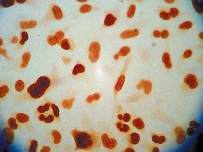 Monoclonal Mouse anti-Human APEX1 / APE1 Antibody (clone 13B8E5C2, IHC, WB)