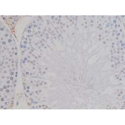 NPM1 / NPM / Nucleophosmin Antibody (phospho-Thr199)