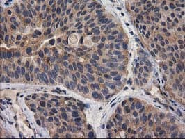 DSTN / Destrin Antibody (clone OTI2C10)
